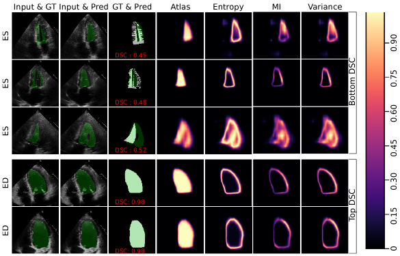 Uncertainty Estimation in Semantic Segmentation of Ultrasound Images