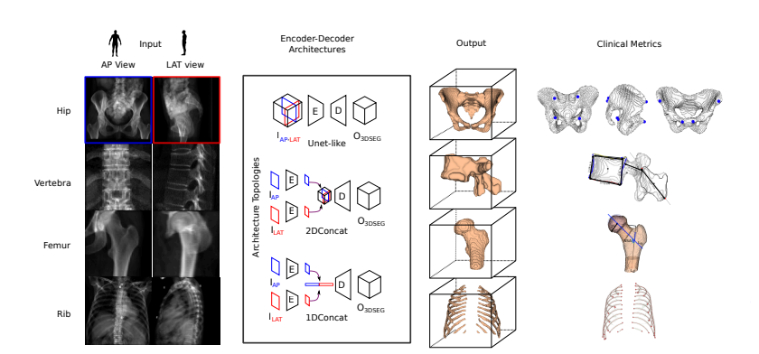 3D Reconstruction from Biplanar X-Ray
