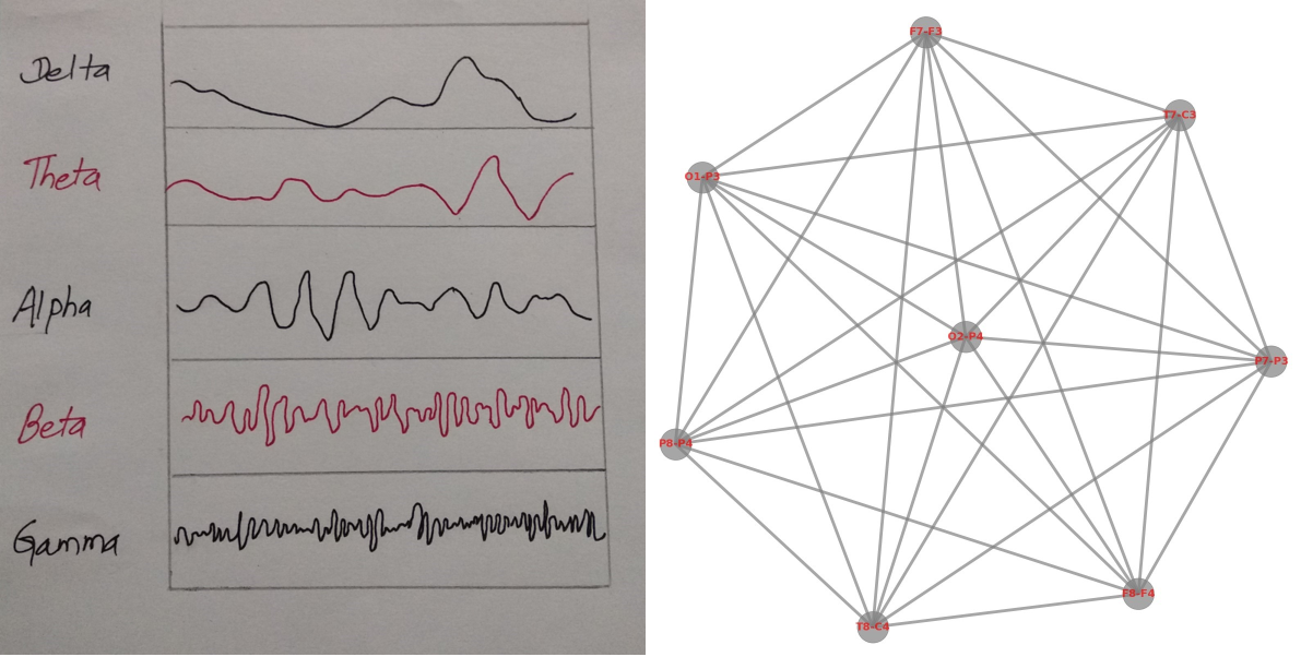 Geometric Deep Learning on Graphs for EEG Datasets